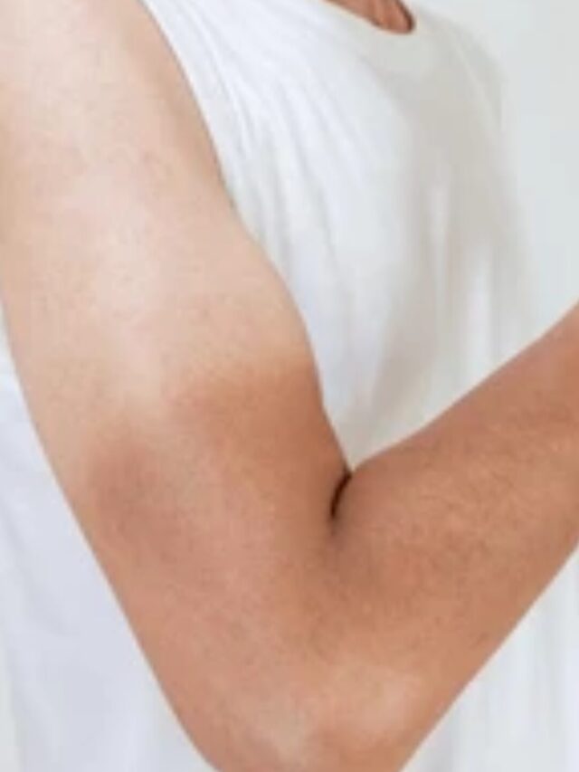 गर्मियों में टैनिंग कैसे हटाएं ?